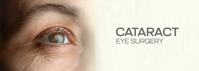 cataract eye surgery in hyderabad - smart vision eye hospitals