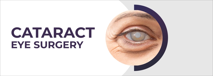 Cataract eye treatment in hyderabad at smartvision eye hospitals