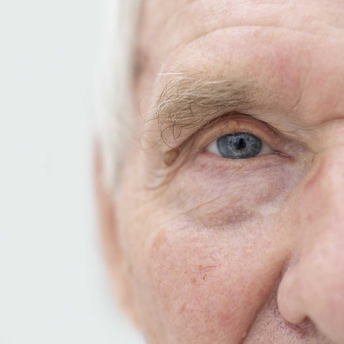 Clear Vision Ahead: 6 Effective Tips for Cataract Prevention