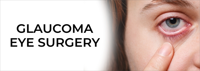 Best glaucoma eye surgery specialist in hyderabad - smart vision eye hospitals