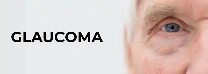 Best glaucoma eye treatment in hyderabad - smart vision eye hospitals