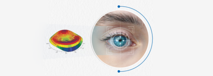 What new technologies are used for lasik eye surgery today | Lasik eye surgery in hyderabad - smart vision eye hospitals