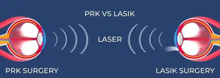 What is the best age for PRK | Lasik eye surgery and how to determine which suits you the best