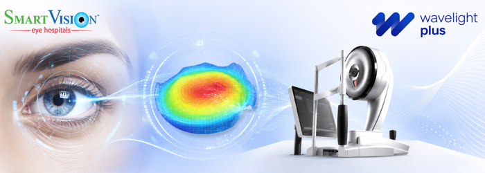 Advanced Wavelight Plus technology using wavefront-guided LASIK to deliver personalized and highly accurate laser vision correction. Wavefront-guided LASIK eye mapping with Wavelight Plus technology for precise and customized vision correction. | SmartVision Eye Hosptials
