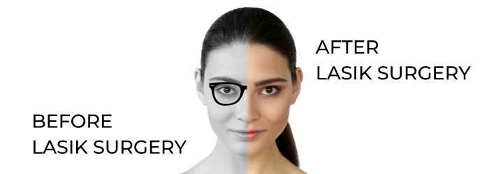 best age for Lasik eye surgery - before and after lasik eye surgery care at smartvision eye hospitals